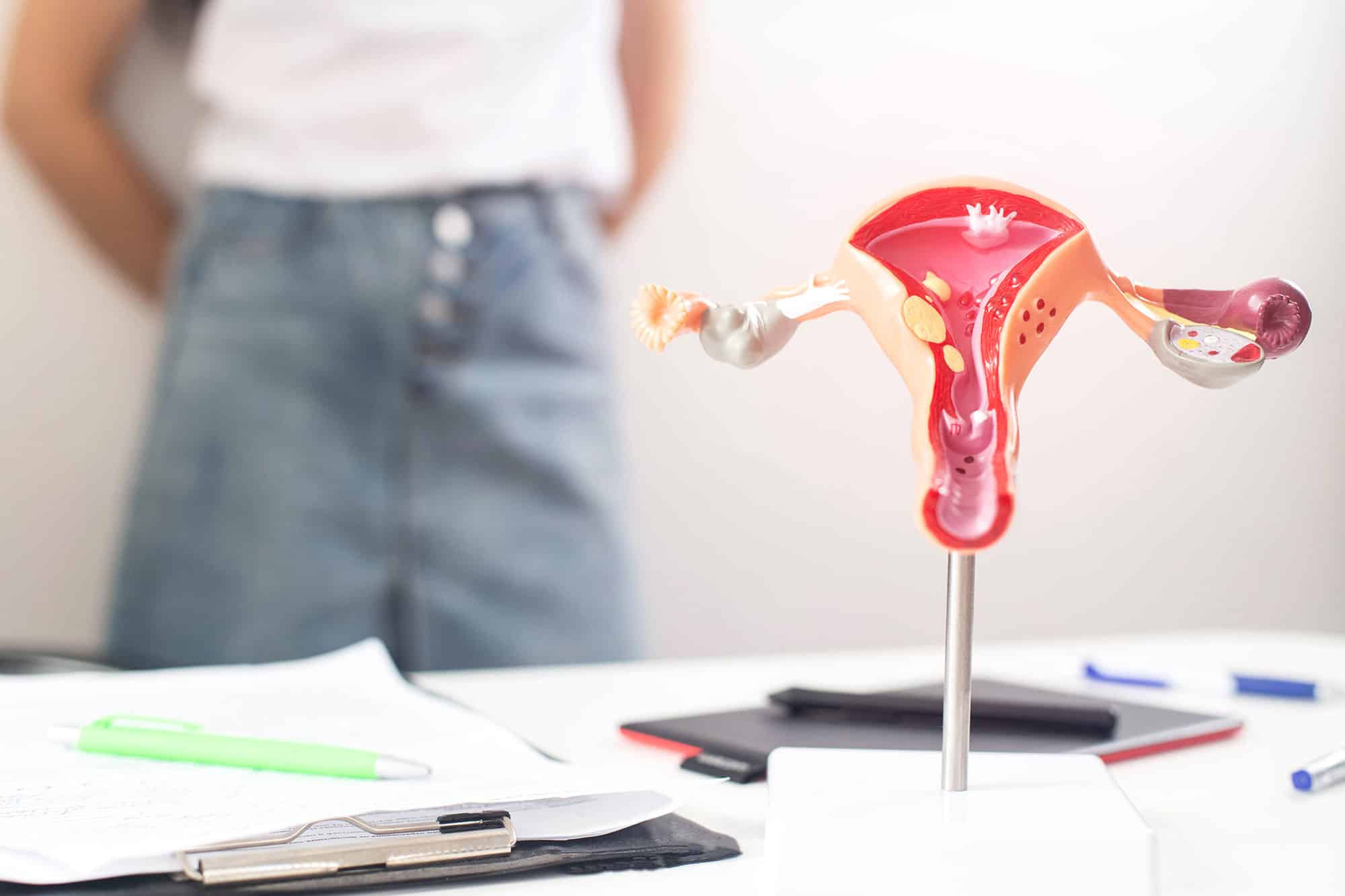 PCOS and Fertility: What You Need to Know
